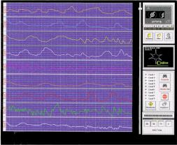Pantalla principal eeg-12