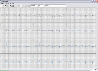 Pantalla principal EcgStudio (12 canales)